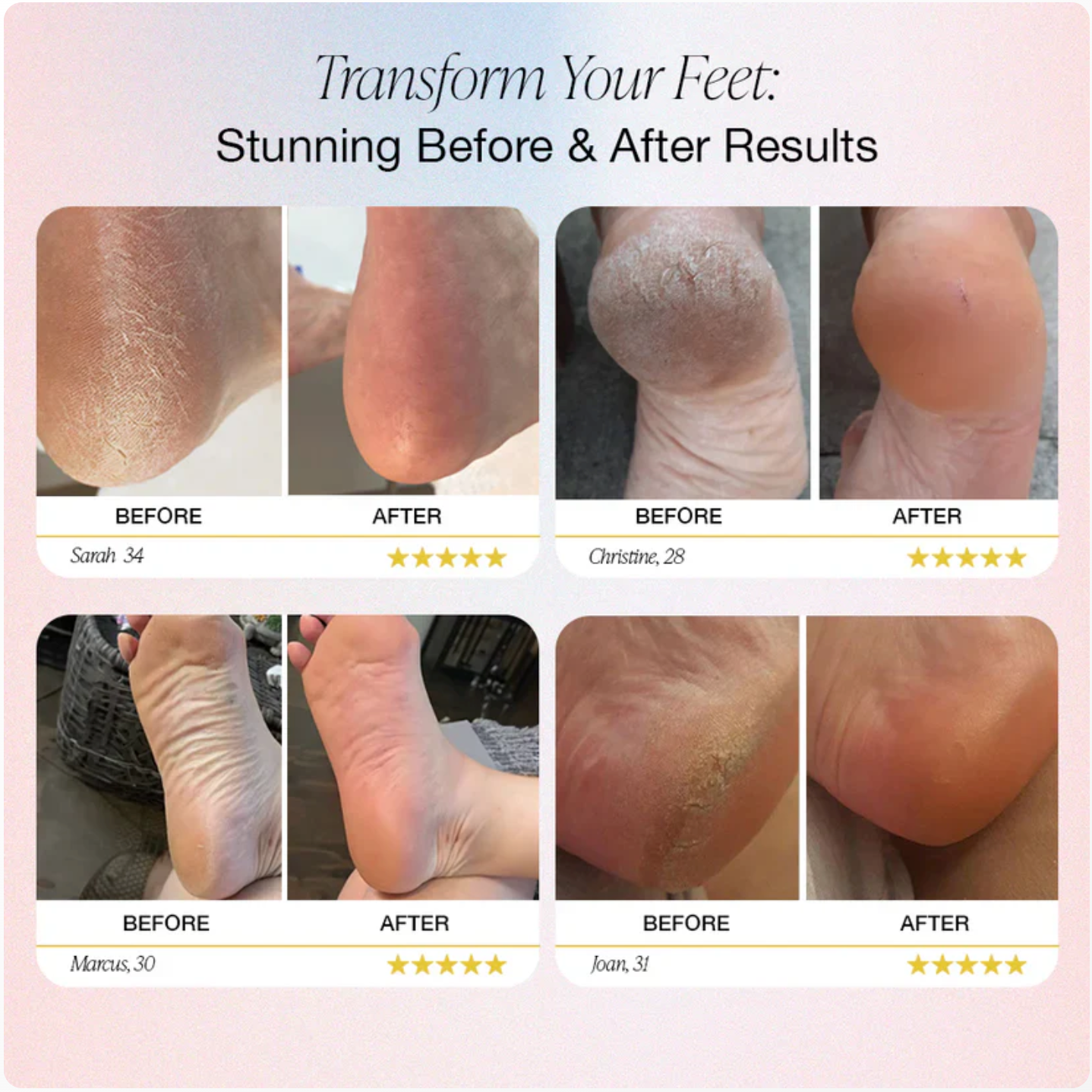 Omi™ Electric Foot Callus Remover