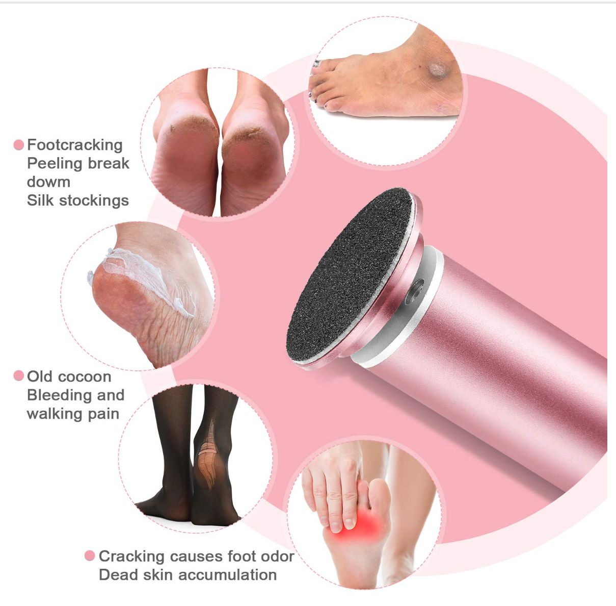 Omi™ Electric Foot Callus Remover